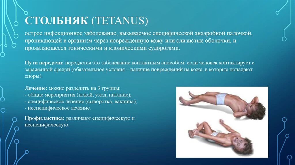 инфографика столбняк